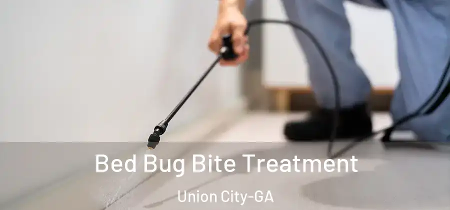 Bed Bug Bite Treatment Union City-GA